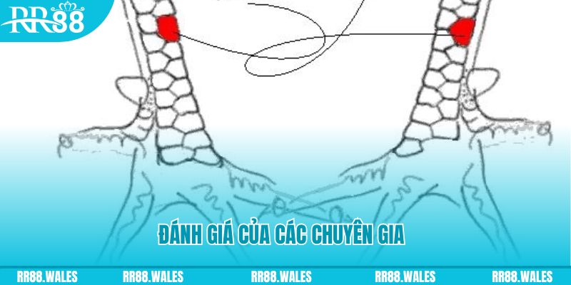 kuwin2 JDB Điện Tử